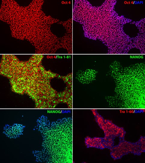 Image 3 - Expression of Pluripotency Markers in iPSC Lines