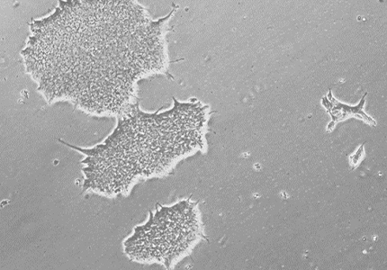 Normal, Human Induced Pluripotent Stem Cells (hiPSCs)