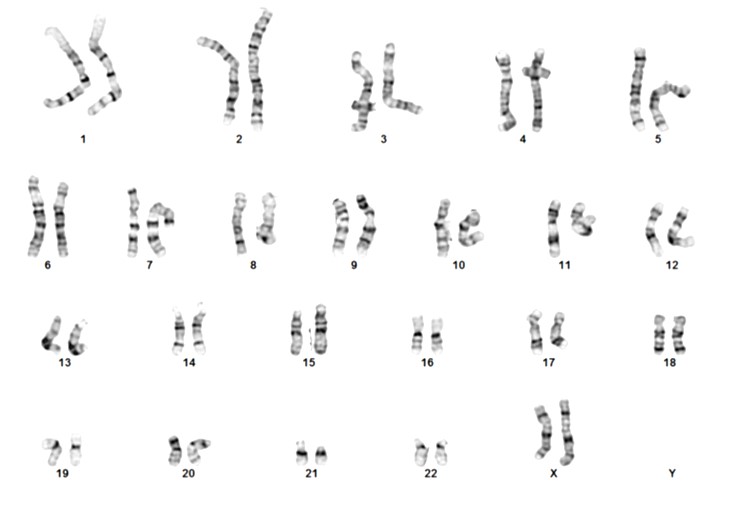 Webpage-ASE-9209-karyotype