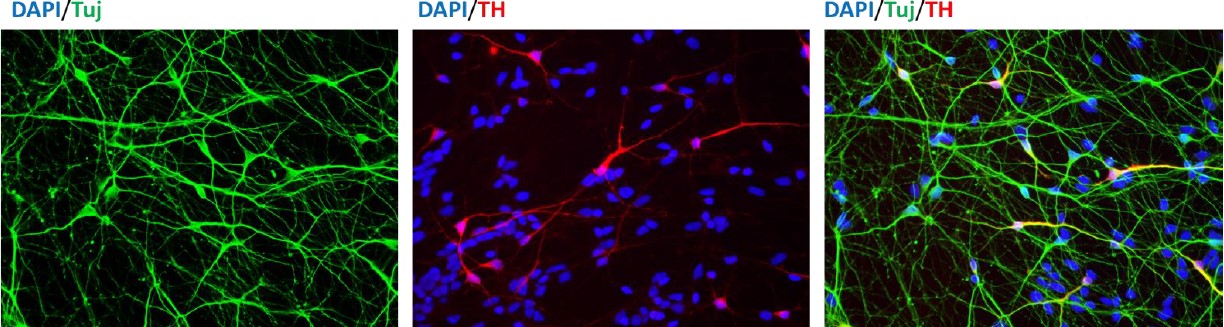 Dopamine Neurons Differentiated from Genome Edited PARK2 -/- iPSCs