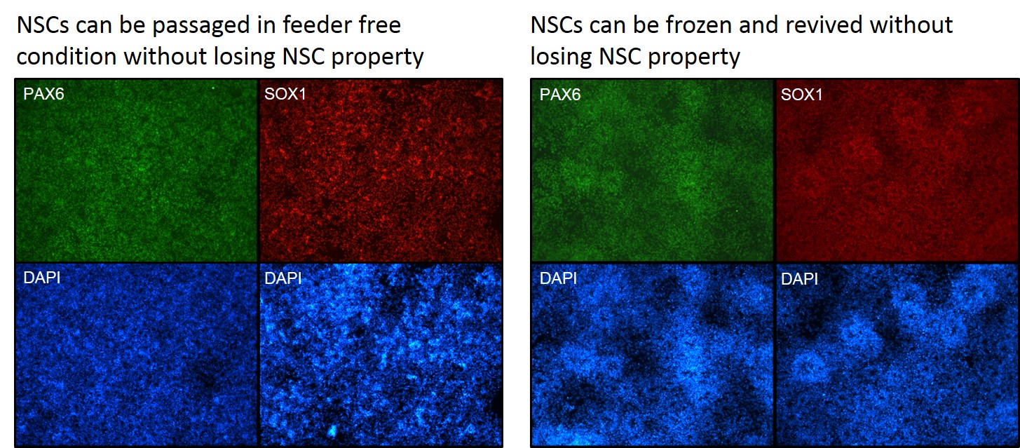 iPSC Differentiation to Neutral Stem Cells Figure 2 - Neutral Stem Cell Differentiation