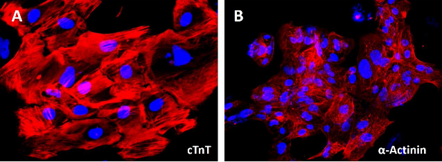 cTnT and a-Actinin Image - Cardiomyocytes Differentiation